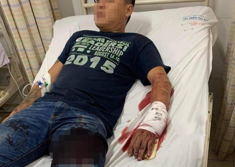 Mot nguoi bi chem gan lia tay o TP Thu Duc hinh anh