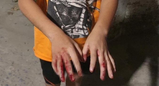 Su that vu be trai o TP.HCM bi cha danh nat tay hinh anh