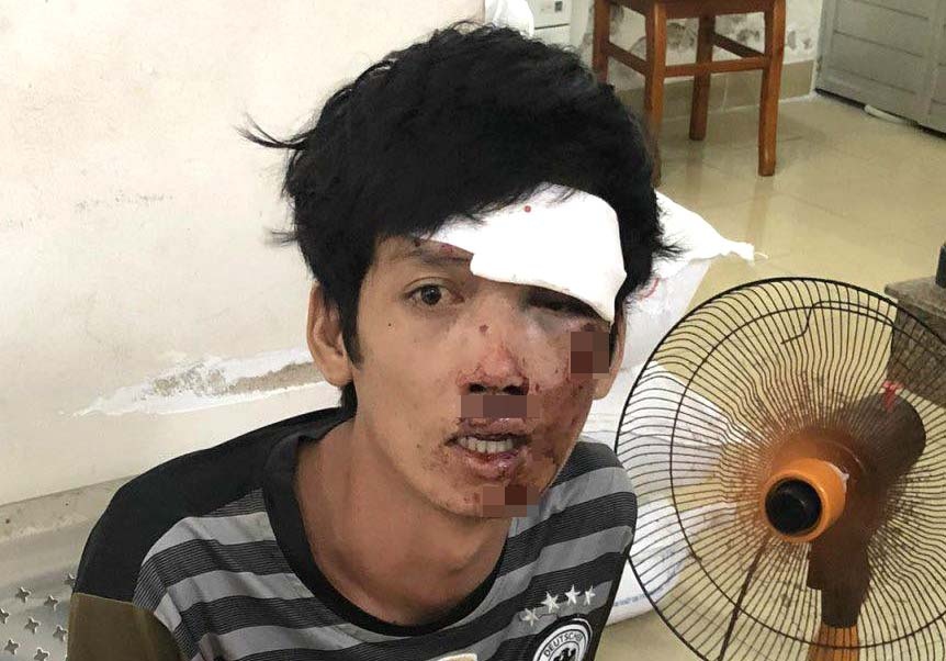 Ten cuop bat tinh khi tong xe vao dai phan cach hinh anh