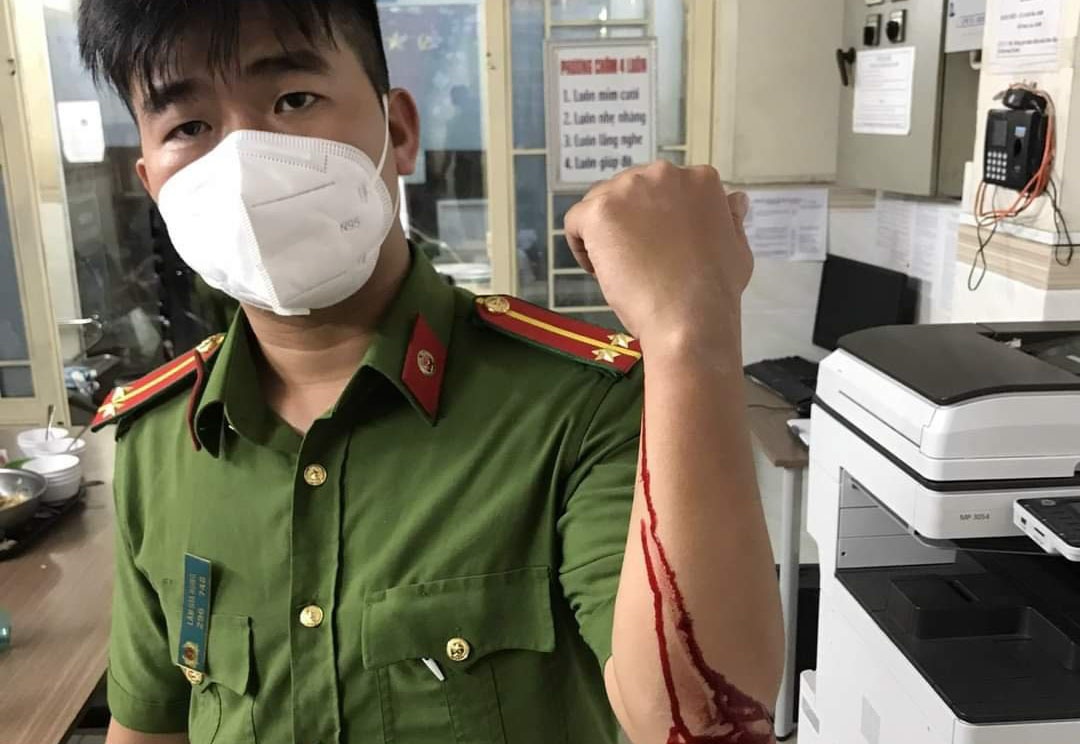 Canh sat khu vuc o TP.HCM bi tan cong khi tuan tra hinh anh