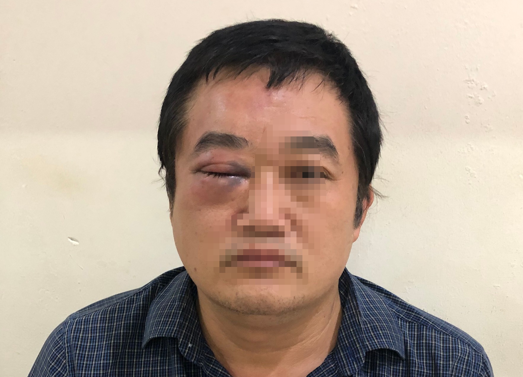 giam doc o TP.HCM bi danh anh 2