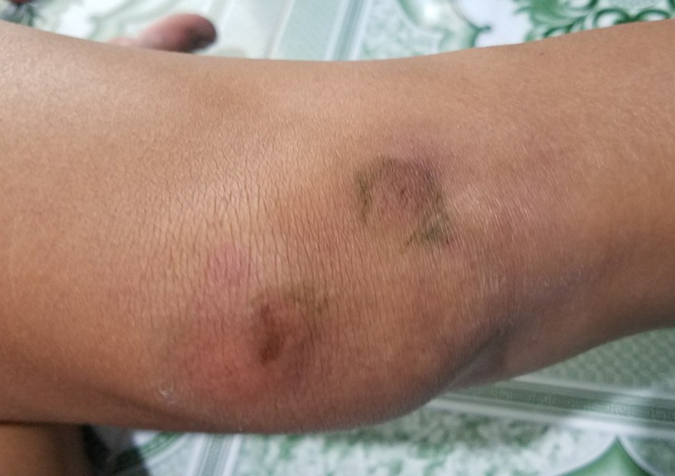 nguoi phu nu hoang bao cuop anh 1