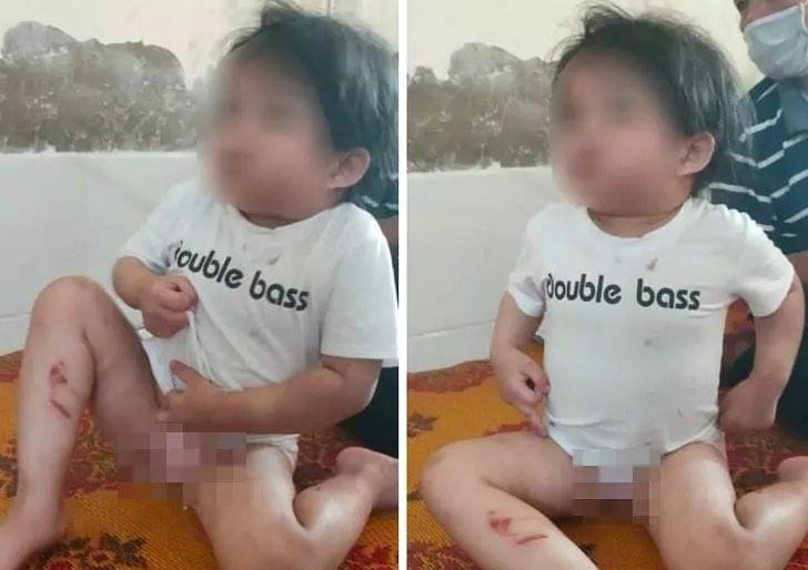 bé gái 4 tuổi bị bạo hành ảnh 1 be gai 4 tuoi bi bao hanh anh 1