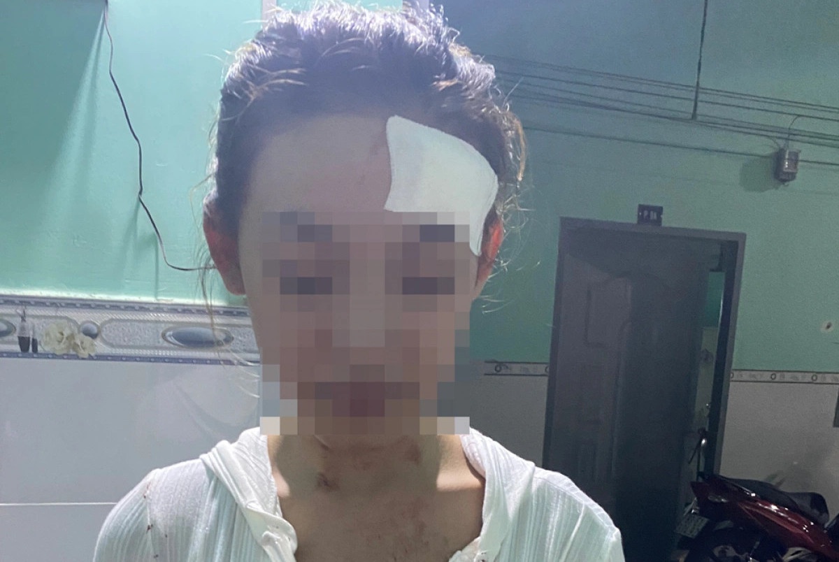 Cong an dieu tra vu nu cong nhan o Binh Duong bi danh hoi dong hinh anh