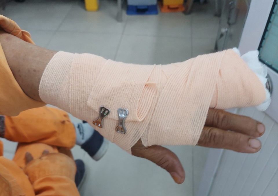 đánh nhân viên điện lực ảnh 1 danh nhan vien dien luc anh 1