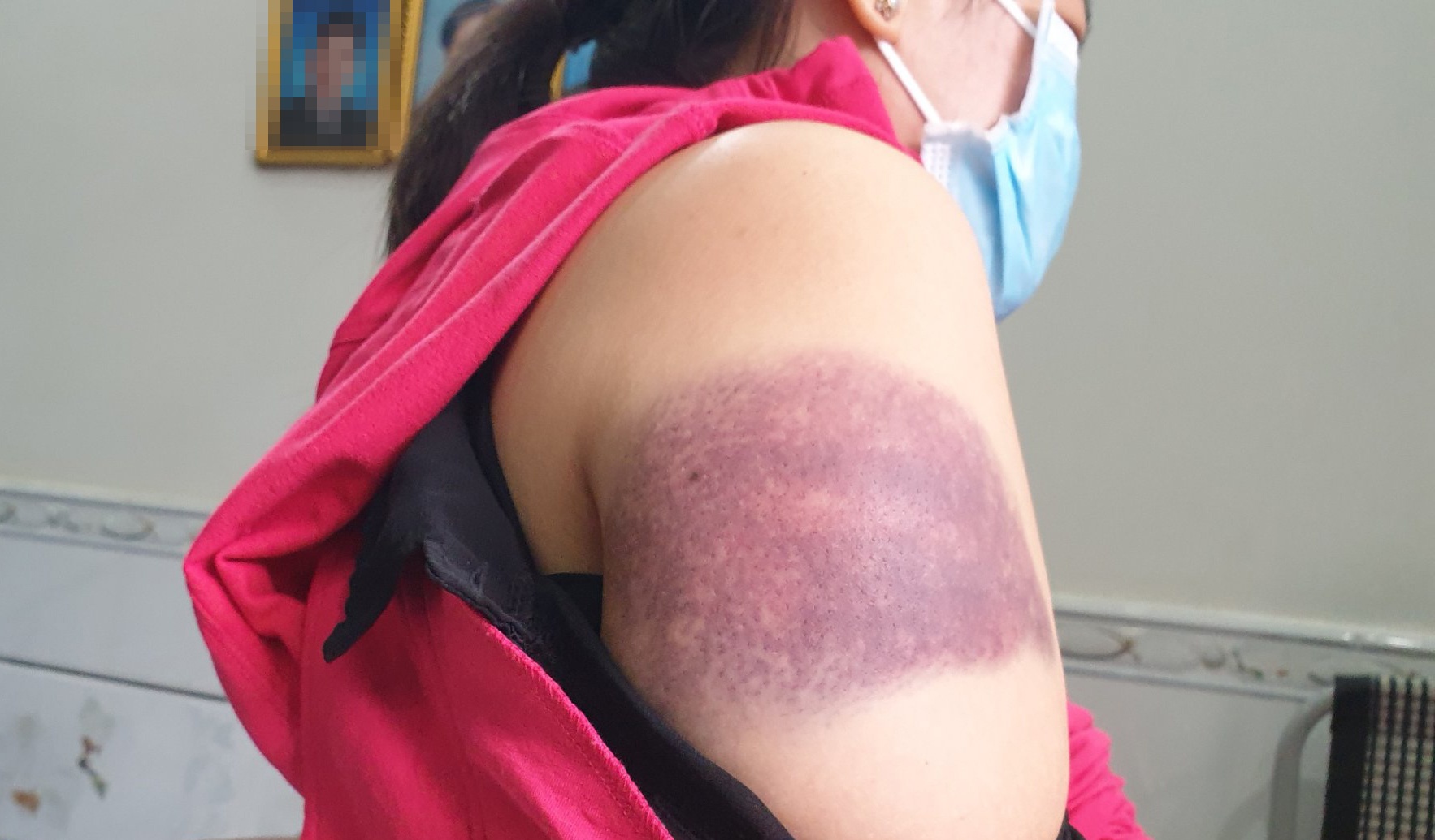 Bao ve dan pho danh nguoi phu nu o TP.HCM hinh anh