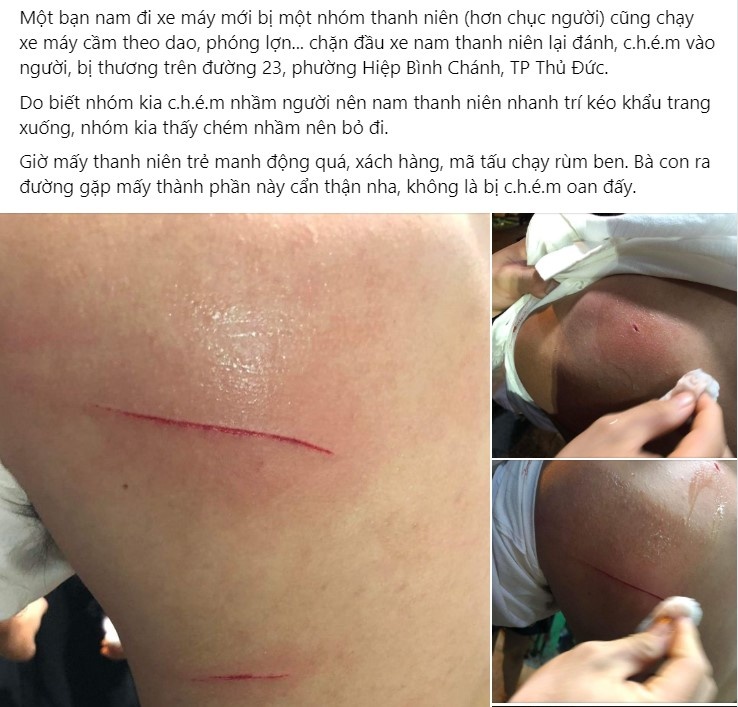 chem nham o Thu Duc anh 1