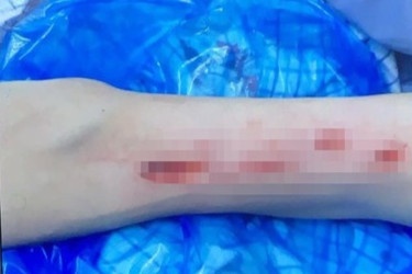 Nguoi dan ong tu rach tay, gia bi cuop xe may hinh anh