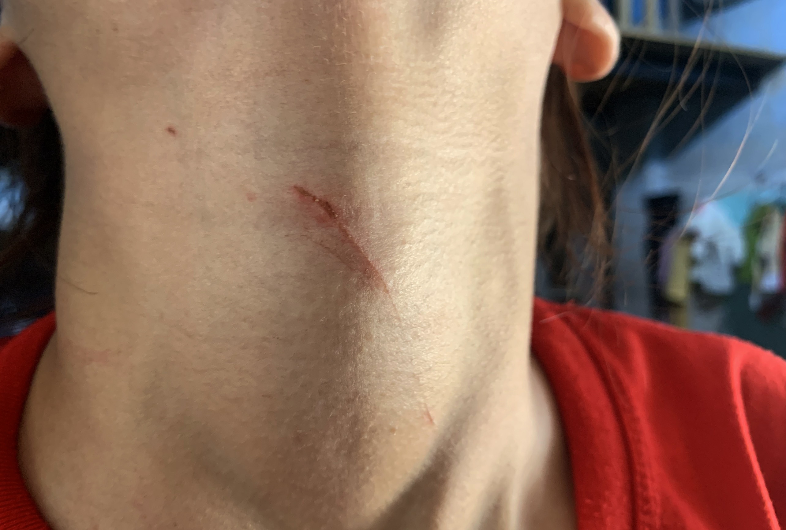 Co gai bi cuop doi bong tai o TP.HCM hinh anh