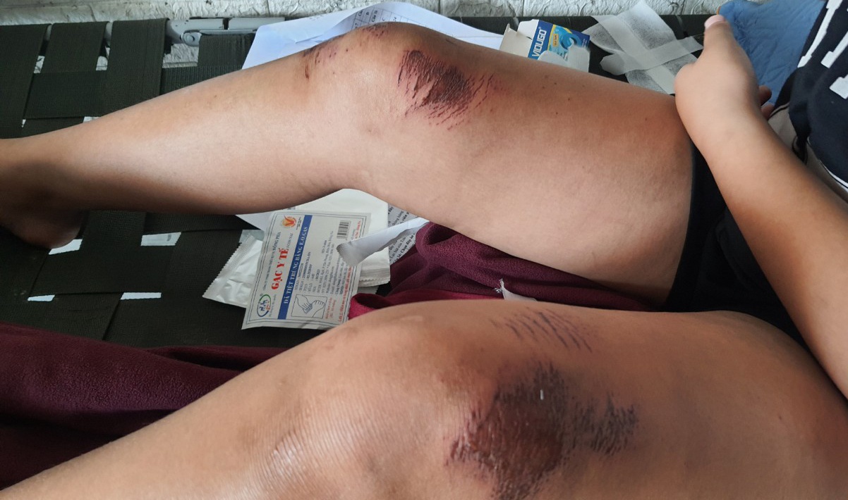 trộm kéo lê bé gái ảnh 1 trom keo le be gai anh 1
