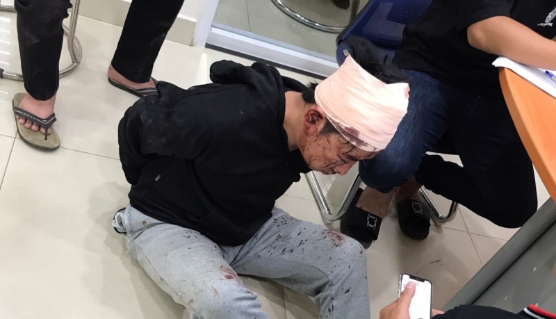 Nghi pham cuop ngan hang Sacombank no nhieu phat sung khi bi bat hinh anh