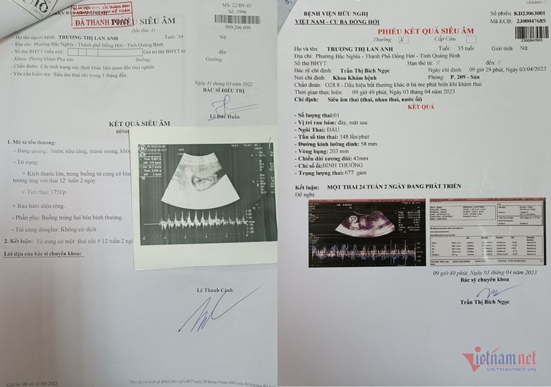 sieu lua o Quang Binh anh 2