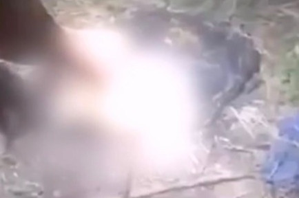 Phat hien doi chan nguoi bi dot chay hinh anh