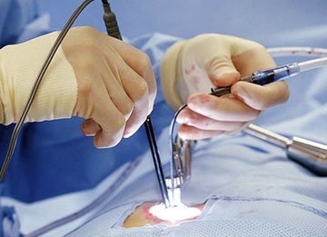 Tam giu mot phu nu nghi nang nguc chui lam chet nguoi o TP.HCM hinh anh