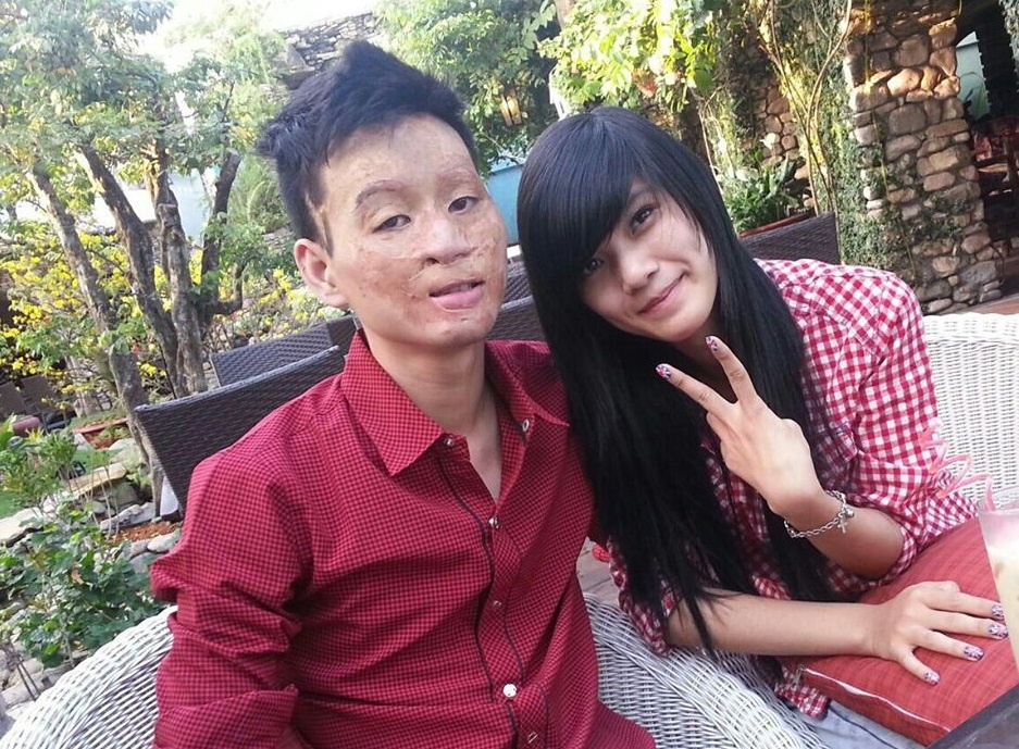 Khoanh khac ngot ngao cua cap chong xau - vo xinh hinh anh