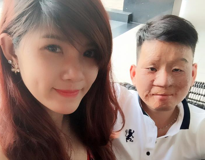 Cap chong xau - vo xinh buc xuc vi bi soi moi hinh anh