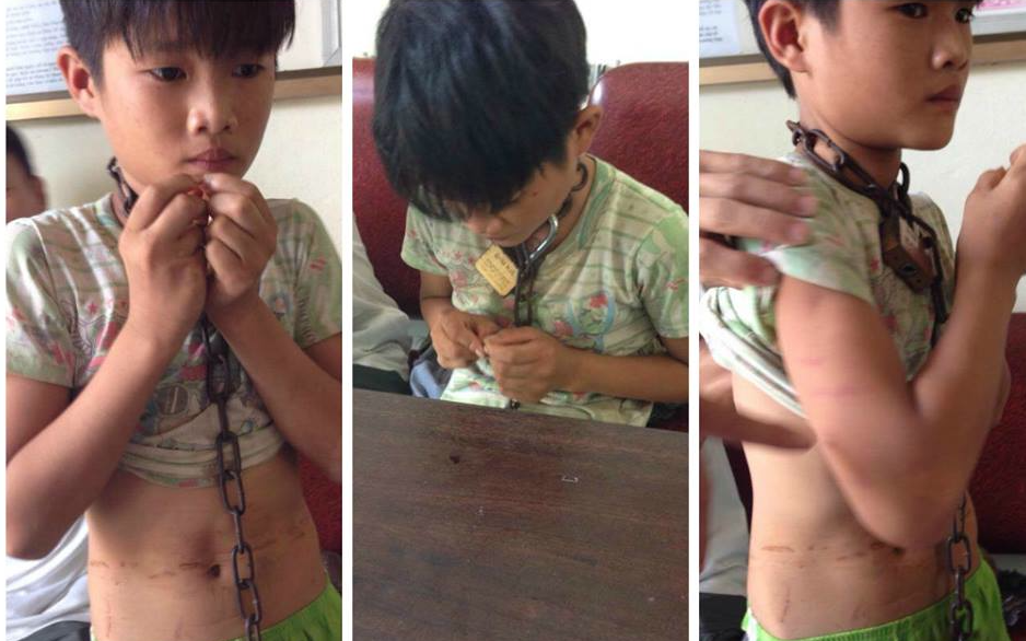 Anh cau be bi xich co o Nghe An khien dan mang xot xa hinh anh