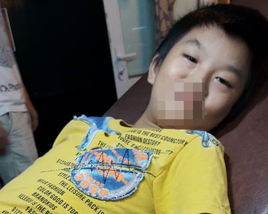 Chang trai 17 tuoi duoc gia dinh xam so dien thoai tren tay hinh anh