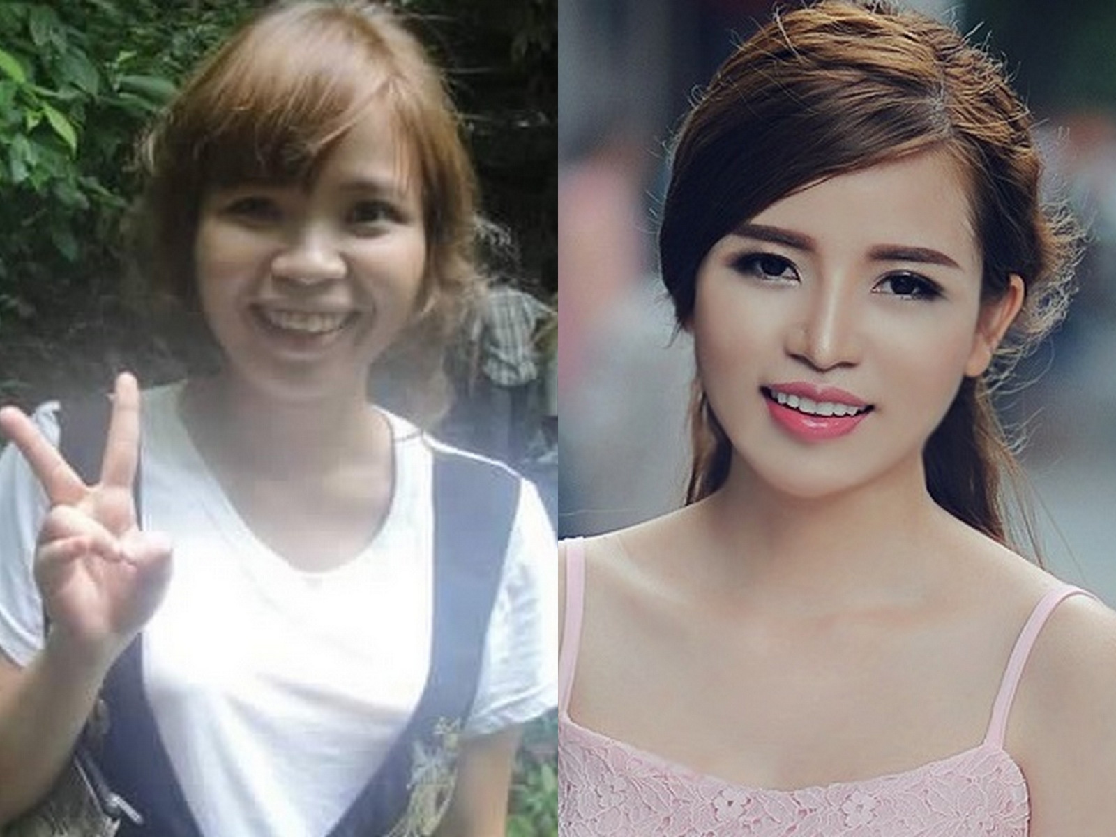 Nhan sac nu thac si sau nhieu lan phau thuat tham my hinh anh