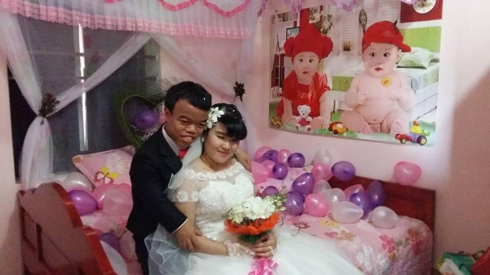 Chuyen tinh chang trai cao 1,2 m va co gai khiem thi hinh anh