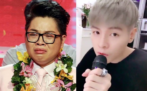 Duc Phuc thay doi khong nhan ra sau phau thuat tham my? hinh anh