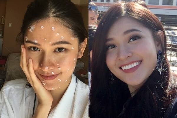 A hau Thuy Dung bi thuy dau truoc them chung ket Hoa hau Quoc te hinh anh