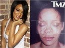 Anh Rihanna bi 'bo' danh bam dap hinh anh