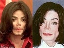 Qua trinh bien dang cua Michael Jackson hinh anh