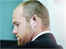 Rooney lo tai rach hinh anh