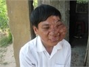 Nguoi dan ong co khuon mat khong lo hinh anh