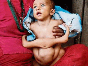 Nepal xon xao vi em be co 8 chi hinh anh