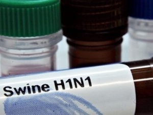 2.000 sinh vien My co trieu chung cum A/H1N1 hinh anh