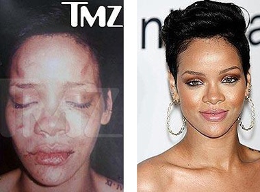 Rihanna lan dau len tieng ve vu bao hanh hinh anh