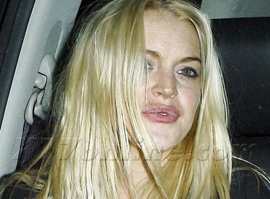 LiLo kho so vi doi moi nut ne hinh anh