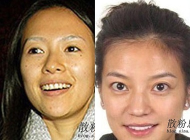 'Soi' mat moc cua Trieu Vy va Chuong Tu Di hinh anh