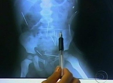 Cha duong cam 40 kim khau vao con trai 2 tuoi hinh anh