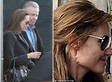 Jolie lo dau vet la tren mat hinh anh