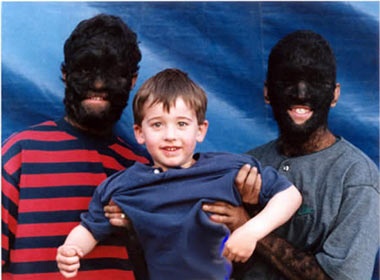 Nhung chung benh ky la nhat trong y hoc hinh anh