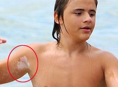 Con trai mac benh bach bien giong Michael Jackson? hinh anh