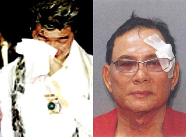 Chan tuong ke tan cong Mr. Dam tai My hinh anh