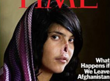 Nguoi vo bi chong danh mat mui noi tieng tren tap chi Time hinh anh