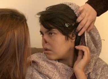 Co gai bi chong cat mui da duoc dua den My hinh anh