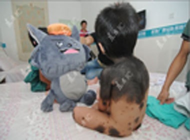 Cau be co nhieu mang long tren nguoi hinh anh