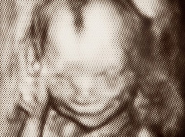 Khuon mat cuoi cua thai nhi 17 tuan tuoi hinh anh