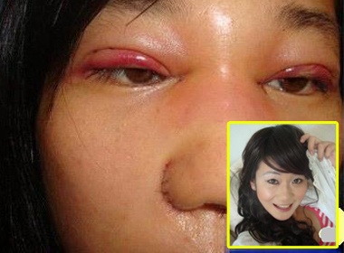 'Choang' voi thieu nu khoe anh phau thuat tham my hinh anh