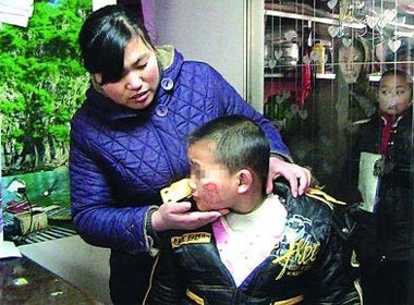 Gi ban la nong vao ma de phat hoc sinh hinh anh