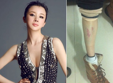 Nguoi dep Hoa ngu bi hanh hung ngay tai phim truong hinh anh