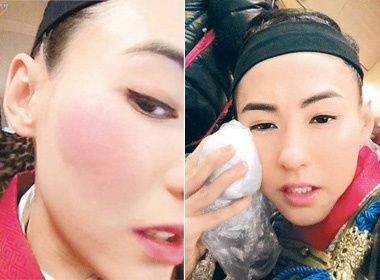 Truong Ba Chi bi thuong tham tim mat hinh anh