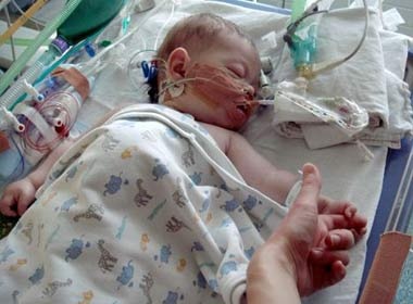 Be 5 thang tuoi tu vong vi bac si quen... rua tay hinh anh