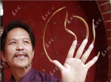 Nguoi co mong tay dai 20 cm hinh anh